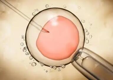 为何自然周期囊胚移植后仍需注射HCG，一分钟了解其作用